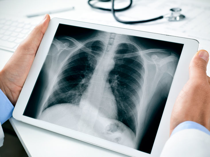 X-ray Scan at SNT Medicare